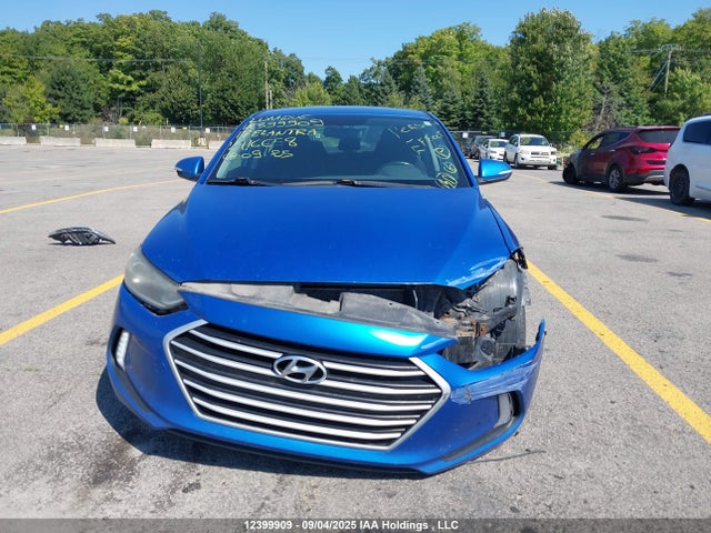 KMHD84LF6HU116658 Hyundai Elantra