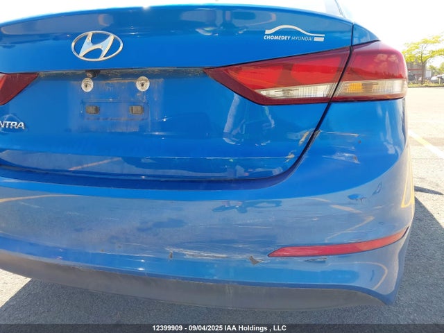 KMHD84LF6HU116658 Hyundai Elantra