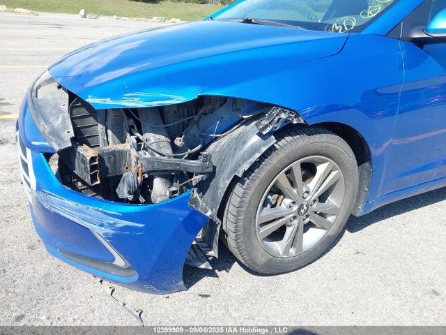 KMHD84LF6HU116658 Hyundai Elantra