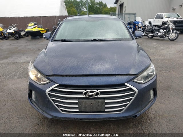 KMHD84LF6HU255480 Hyundai 2017