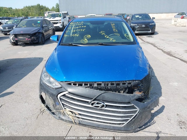 KMHD84LF3JU581436 Hyundai mpi nu