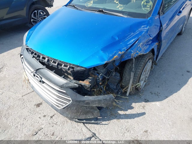 KMHD84LF3JU581436 Hyundai mpi nu