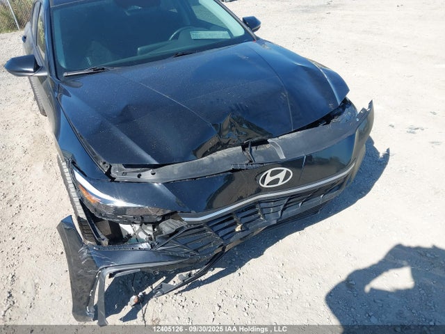 KMHLM4DG3RU666884 Hyundai mpi nu pe