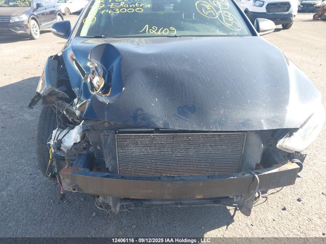 KMHD84LF9HU143000 Hyundai Elantra