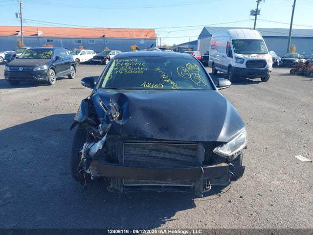 KMHD84LF9HU143000 Hyundai Elantra