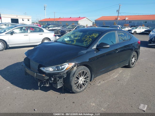 KMHD84LF9HU143000 Hyundai Elantra