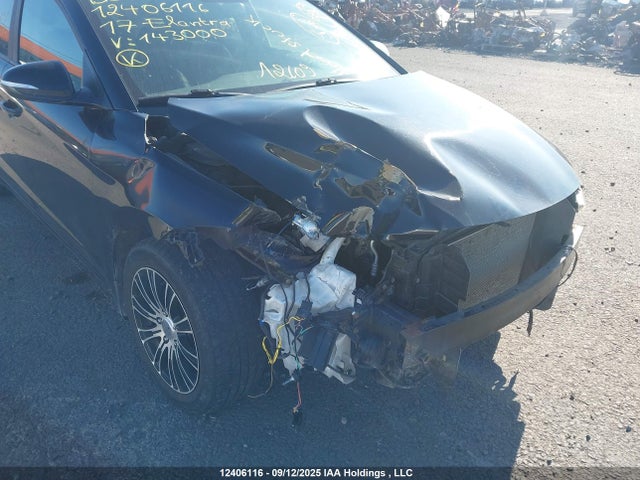 KMHD84LF9HU143000 Hyundai Elantra