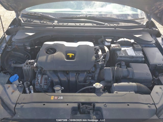 KMHD84LF0LU029119 Hyundai mpi nu