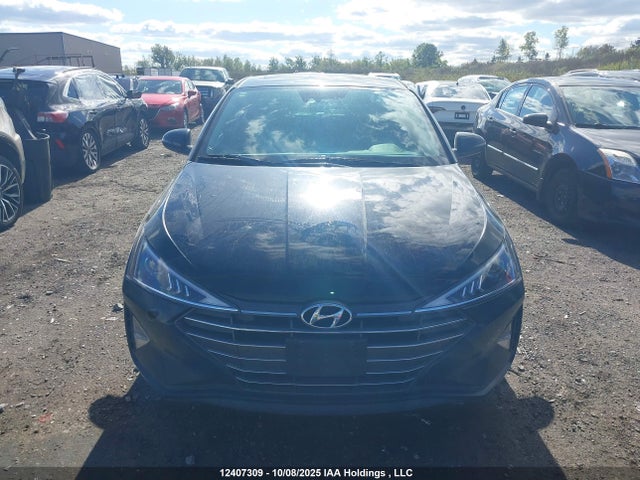 KMHD84LF0LU029119 Hyundai mpi nu