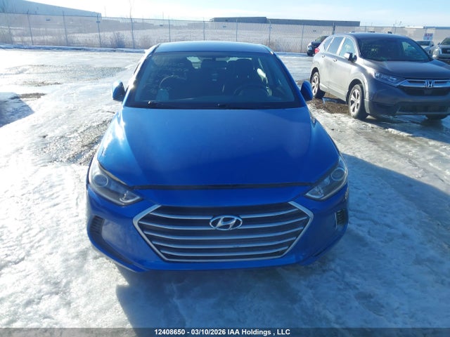 KMHD84LF2JU638807 Hyundai ELANTRA GL