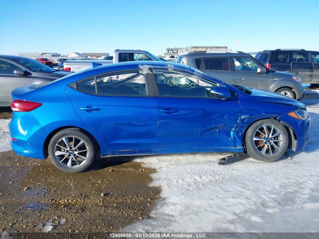 KMHD84LF2JU638807 Hyundai ELANTRA GL