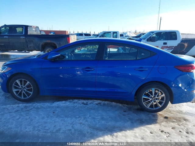 KMHD84LF2JU638807 Hyundai ELANTRA GL