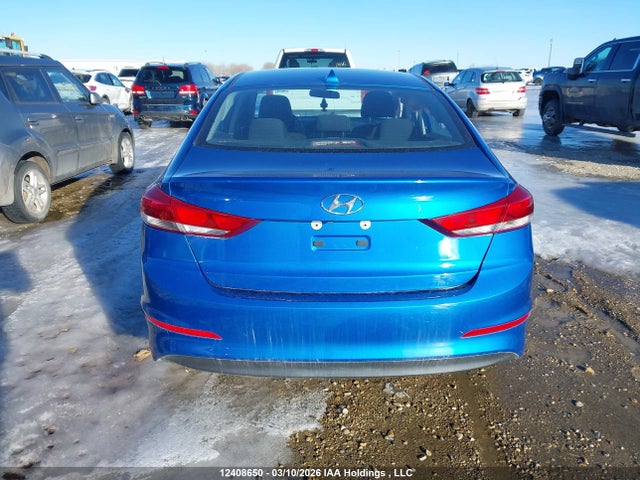 KMHD84LF2JU638807 Hyundai ELANTRA GL