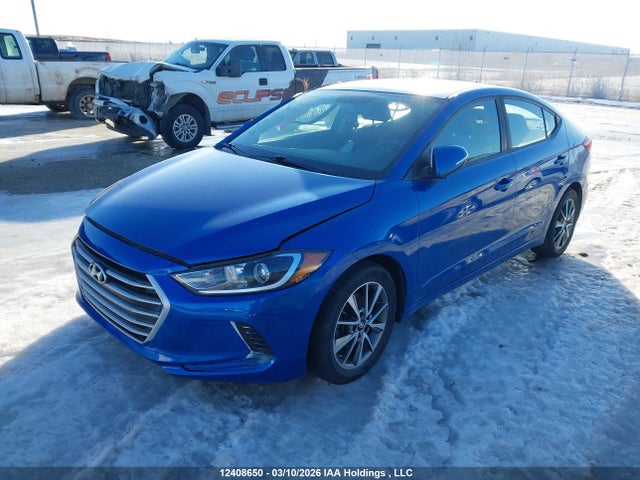 KMHD84LF2JU638807 Hyundai ELANTRA GL