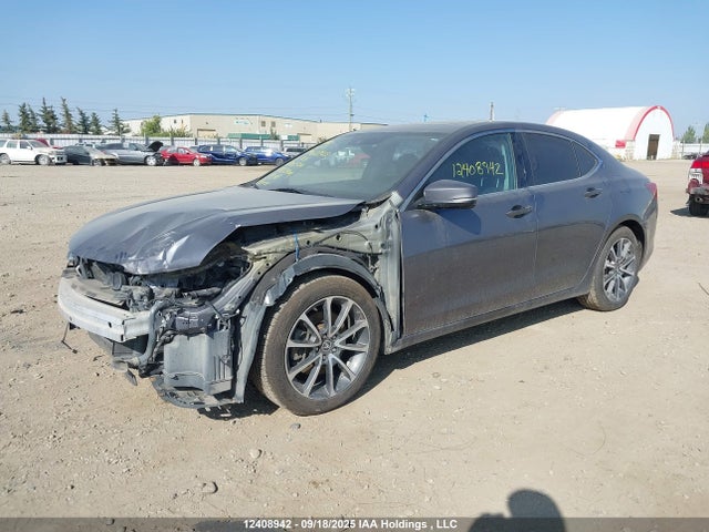 Acura j35y6 2017 19UUB3F55HA800574 Image 2