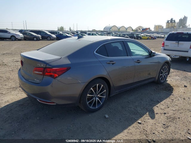 Acura j35y6 2017 19UUB3F55HA800574 Image 4