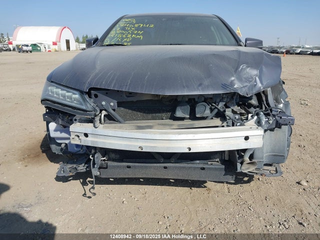 Acura j35y6 2017 19UUB3F55HA800574 Image 6
