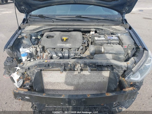 KMHD84LF9HU098950 Hyundai Elantra