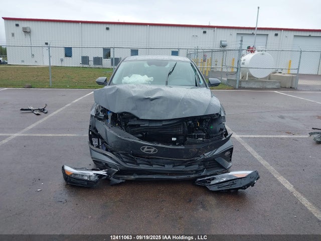 KMHLM4DGXSU036298 Hyundai mpi nu pe