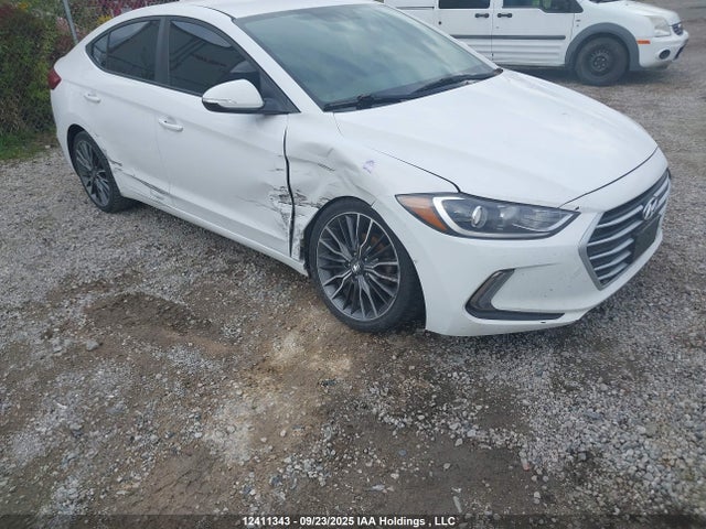 KMHD84LF8HU346041 Hyundai 2017