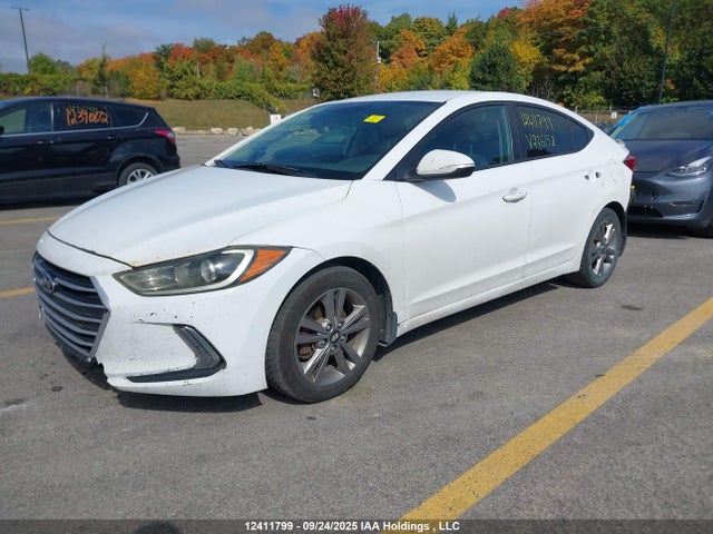 KMHD84LF7HU276158 Hyundai Elantra