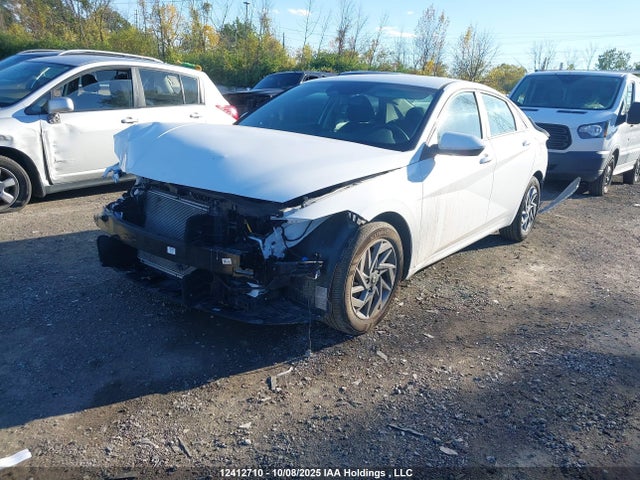 KMHLM4DG5RU794981 Hyundai mpi nu pe