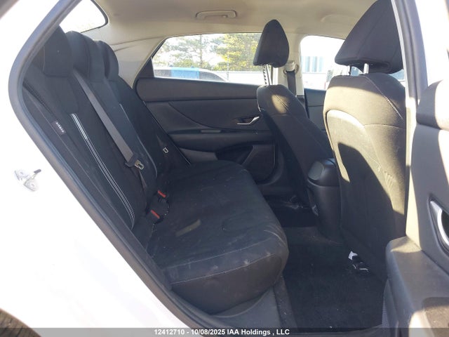 KMHLM4DG5RU794981 Hyundai mpi nu pe