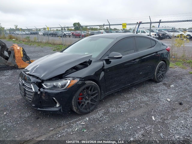 KMHD84LF0JU661261 Hyundai mpi nu