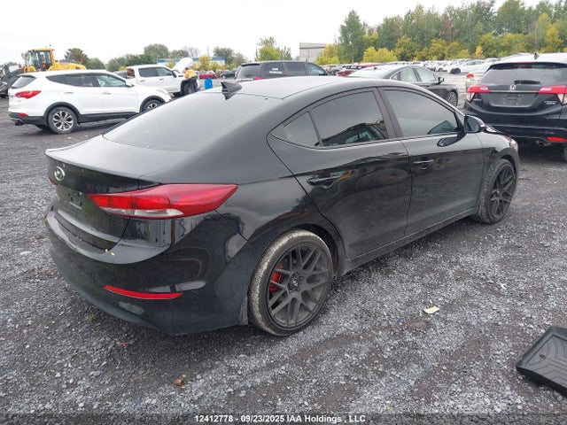 KMHD84LF0JU661261 Hyundai mpi nu