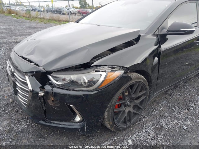 KMHD84LF0JU661261 Hyundai mpi nu