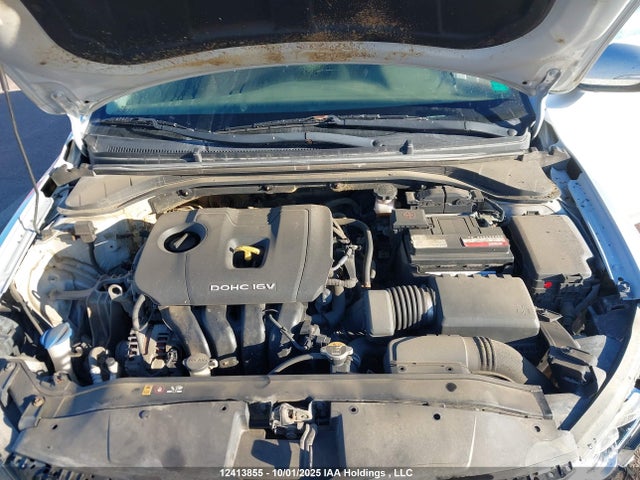KMHD84LF1HU374344 Hyundai Elantra