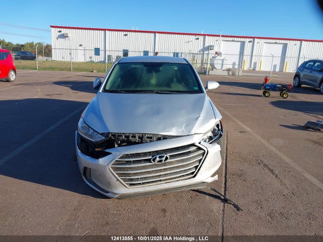 KMHD84LF1HU374344 Hyundai Elantra