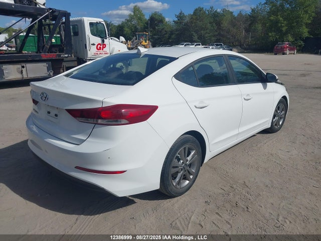 KMHD84LFXJU649828 Hyundai mpi nu