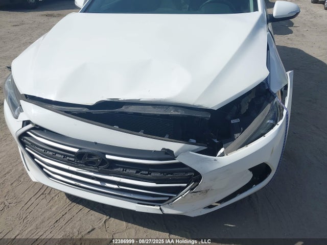 KMHD84LFXJU649828 Hyundai mpi nu