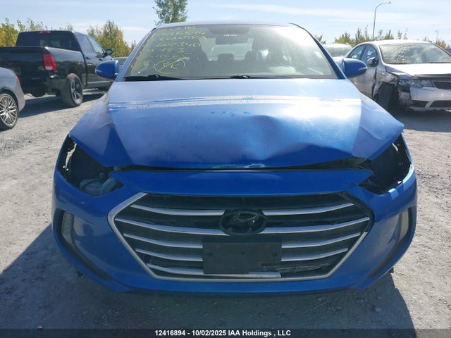KMHD84LF9JU602340 Hyundai Elantra