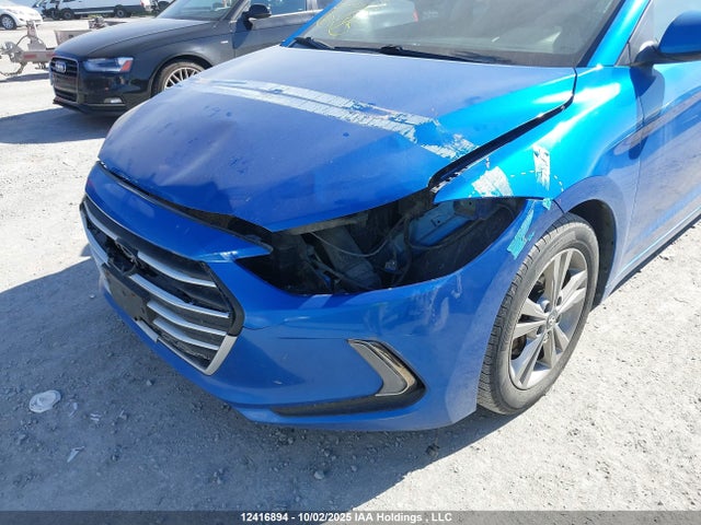 KMHD84LF9JU602340 Hyundai Elantra