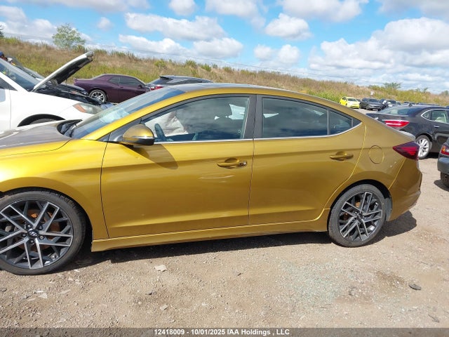 KMHD04LB0KU885832 Hyundai g 1.6 dohc t-gdi