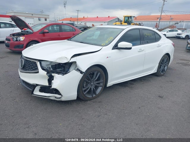 Acura j35y6 2020 19UUB3F40LA800210 Image 2