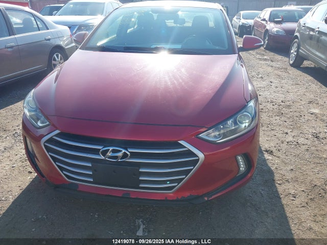 KMHD84LF2JU691930 Hyundai mpi nu
