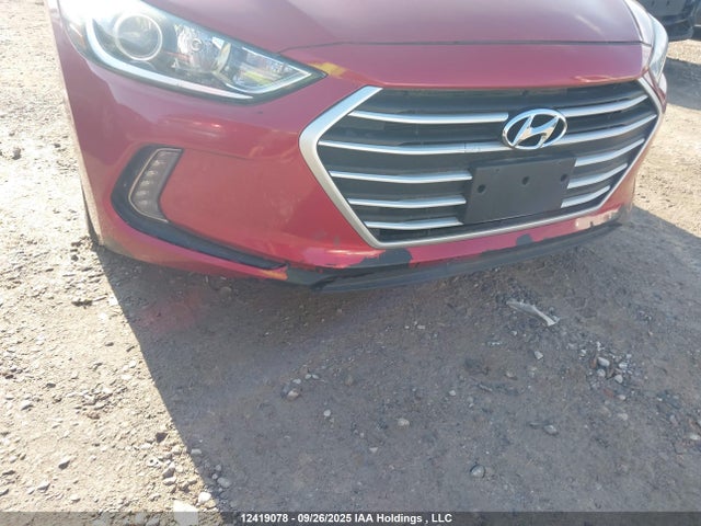 KMHD84LF2JU691930 Hyundai mpi nu