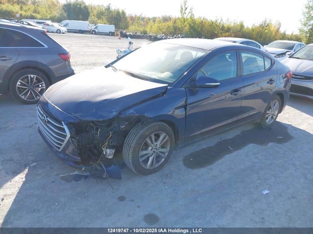 KMHD84LF1HU340405 Hyundai Elantra