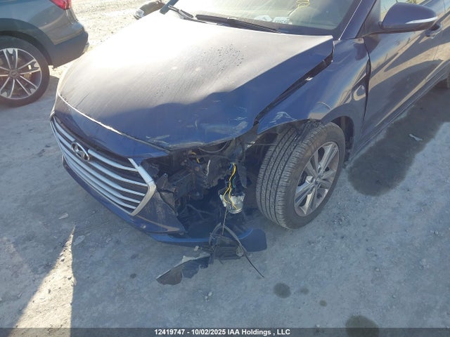 KMHD84LF1HU340405 Hyundai Elantra