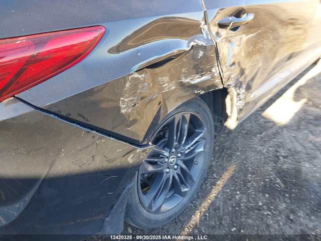 Acura k20c4 2021 5J8TC2H6XML803316 Image 6