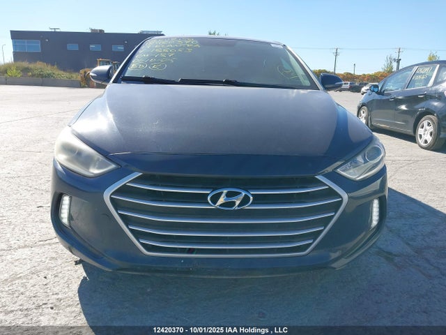 KMHD84LF2HU188053 Hyundai Elantra