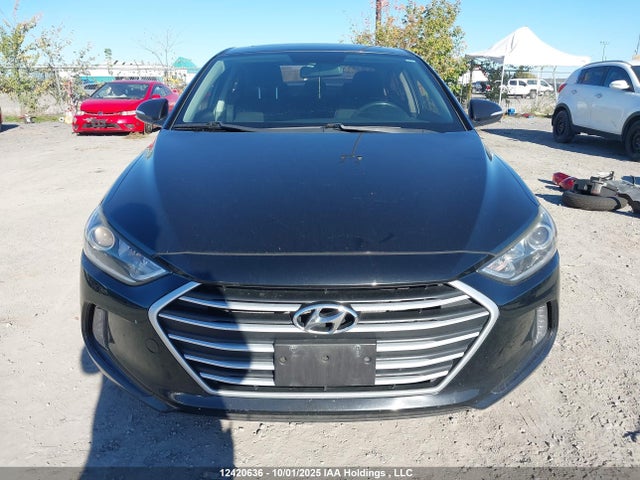 KMHD84LF6JU676167 Hyundai mpi nu