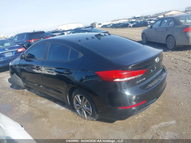 KMHD84LF5HU129532 Hyundai ELANTRA GL
