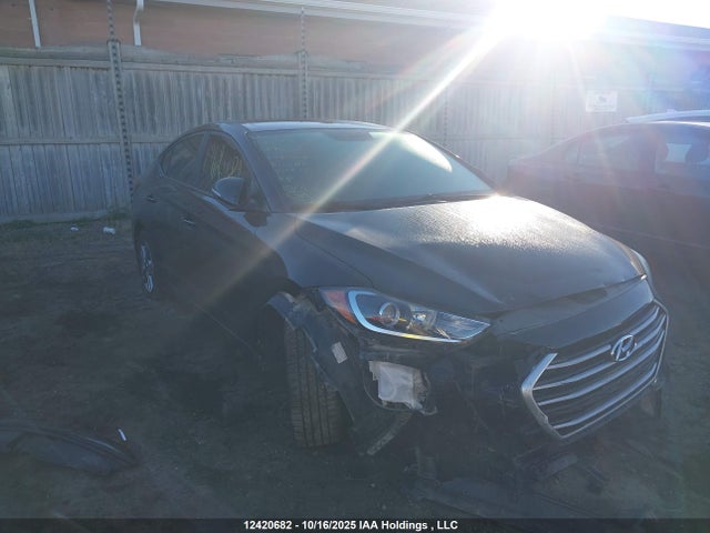 KMHD84LF5HU129532 Hyundai ELANTRA GL
