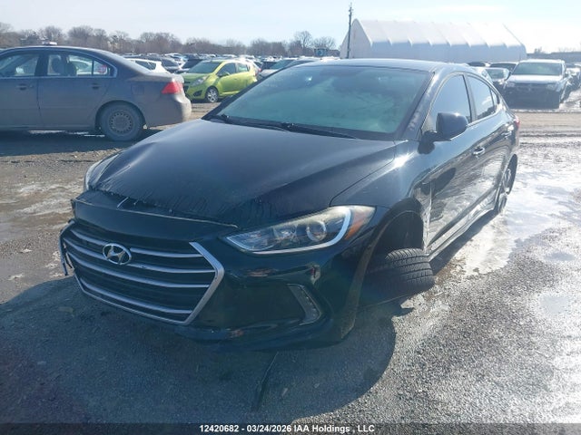 KMHD84LF5HU129532 Hyundai ELANTRA GL