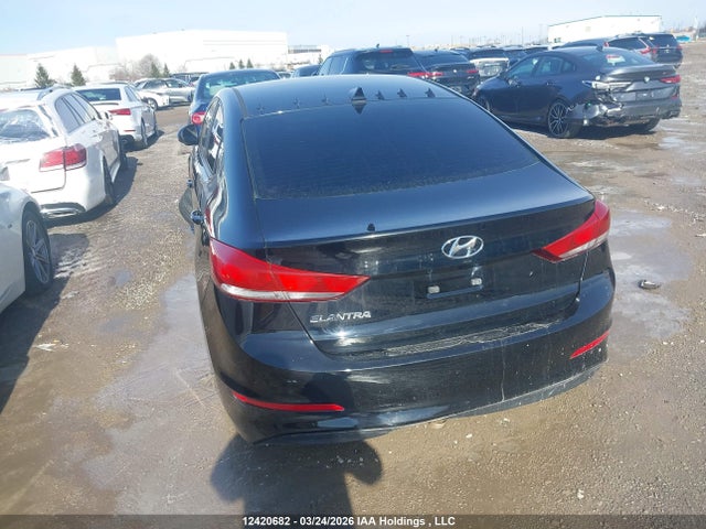 KMHD84LF5HU129532 Hyundai ELANTRA GL