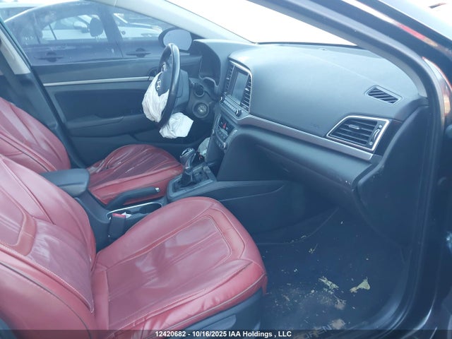 KMHD84LF5HU129532 Hyundai ELANTRA GL